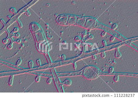 Fungus Trichophyton tonsurans, 3D illustration Fungus Trichophyton tonsurans, 3D illustration 111228237