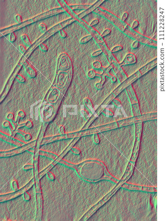 Fungus Trichophyton tonsurans, 3D illustration Fungus Trichophyton tonsurans, 3D illustration 111228247
