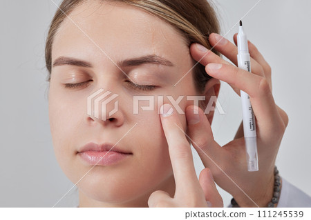 plastic surgeon prepares for Blepharoplasty, Blepharoplasty operation plastic surgeon prepares for Blepharoplasty, Blepharoplasty operation 111245539