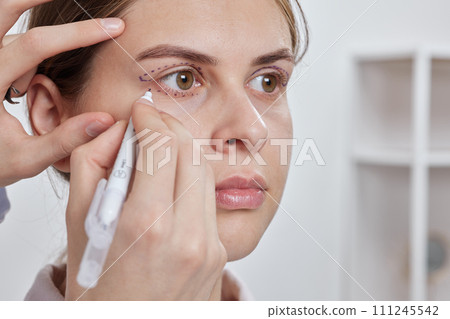 plastic surgeon prepares for Blepharoplasty, Blepharoplasty operation plastic surgeon prepares for Blepharoplasty, Blepharoplasty operation 111245542