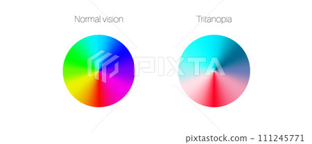 Tritanopia and tritanomaly Tritanopia and tritanomaly 111245771