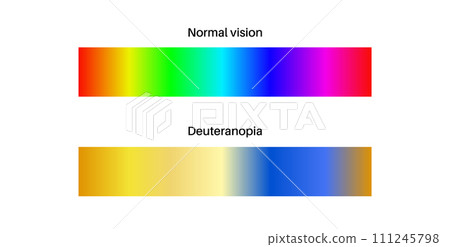 Deuteranomaly and deuteranopia 111245798