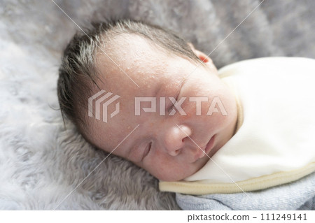 新生兒濕疹 新生兒濕疹 111249141