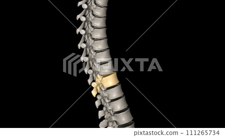 Thoracic Vertebral, T10 111265734
