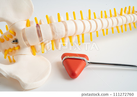Human spinal nerve and bone with percussion reflex hammer, model for treatment medical in the orthopedic department. Human spinal nerve and bone with percussion reflex hammer, model for treatment medical in the orthopedic department. 111272760