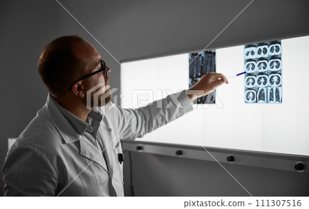 Side view of male doctor studying MRI results. Male specialist working in hospital, carrying out description of the radiographs of patient, pointing by pen. Specialist wearing glasses and white robe. Side view of male doctor studying MRI results. Male specialist working in hospital, carrying out description of the radiographs of patient, pointing by pen. Specialist wearing glasses and white robe. 111307516