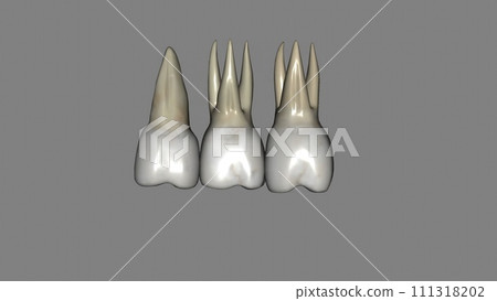 The maxillary first molars are three rooted, two buccal and one palatal The maxillary first molars are three rooted, two buccal and one palatal 111318202