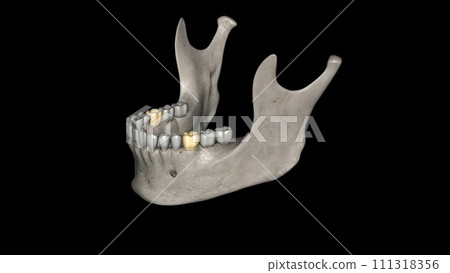 The mandibular first molar usually has two roots, a mesial and a distal The mandibular first molar usually has two roots, a mesial and a distal 111318356