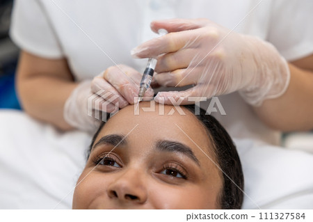 Young woman having a session of hair plasmotherapy 111327584