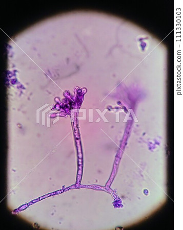 Growing conidia of Aspergillus genus Growing conidia of Aspergillus genus 111330103