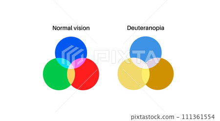 Deuteranomaly and deuteranopia 111361554