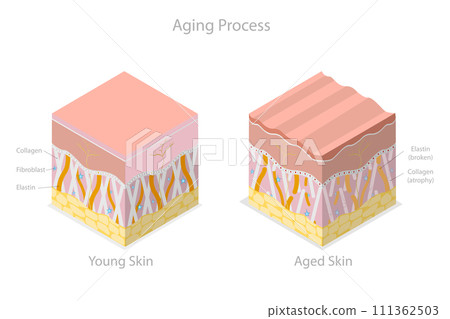3D Isometric Flat Conceptual Illustration of Aging Process, Skin Age-related Changes 3D Isometric Flat Conceptual Illustration of Aging Process, Skin Age-related Changes 111362503
