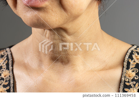 Neck wrinkles and lines of senior woman. Facial and Neck Skin Aging Change on senior woman. 111369458