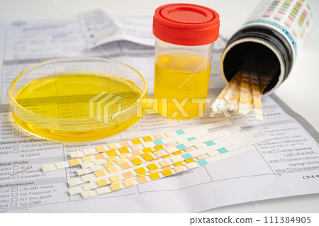 Urinalysis, urine cup with reagent strip pH paper test and comparison chart in laboratory. 111384905
