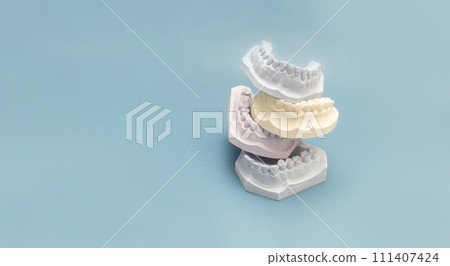 Mockup Many Die Stone, Plaster Cast Molds Of The Upper And Lower Jaws And Teeth With Pliable Imprint In Lab On Blue Background. Denture. Dental Gypsum Model, Space for Text. Prosthetics. Horizontal. Mockup Many Die Stone, Plaster Cast Molds Of The Upper And Lower Jaws And Teeth With Pliable Imprint In Lab On Blue Background. Denture. Dental Gypsum Model, Space for Text. Prosthetics. Horizontal. 111407424