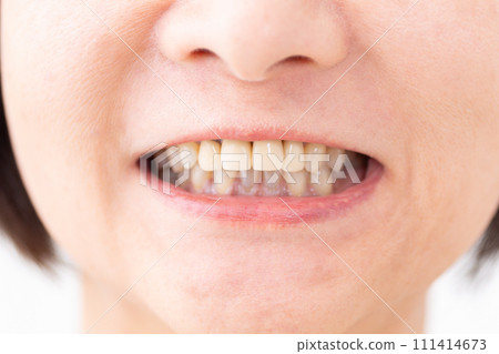 中間女人的牙齒 111414673