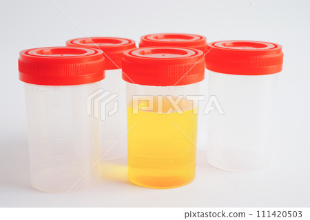 Urinalysis, urine cup for check health examination in laboratory. Urinalysis, urine cup for check health examination in laboratory. 111420503