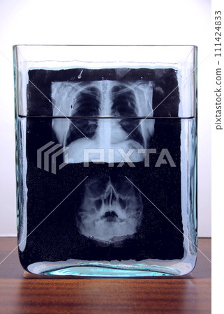 Radiography results film of human skull x-ray scanning in glass laboratory vessel with liquid Radiography results film of human skull x-ray scanning in glass laboratory vessel with liquid 111424833