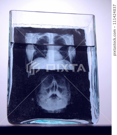 X-ray image with results of human brain radiography analysis in rectangular glass vessel 111424837