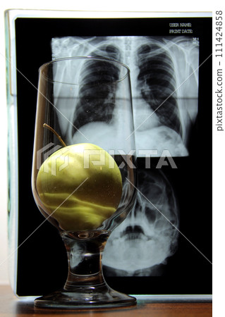 Health against diseases. Apple in clear glass over radiography image of brain disease x-ray analysis 111424858