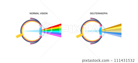 Deuteranomaly and deuteranopia Deuteranomaly and deuteranopia 111431532