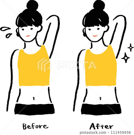 女性插圖之前和之後的腋窩 111450936