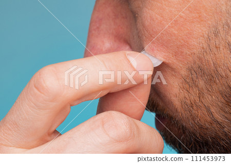 Girl with acne stick round acne patch on her cheek. Using acne patches for treatment of pimple and rosacea close-up. Facial rejuvenation cleansing cosmetology Girl with acne stick round acne patch on her cheek. Using acne patches for treatment of pimple and rosacea close-up. Facial rejuvenation cleansing cosmetology 111453973