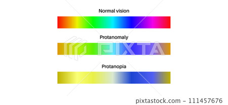 Protanomaly and protanopia Protanomaly and protanopia 111457676