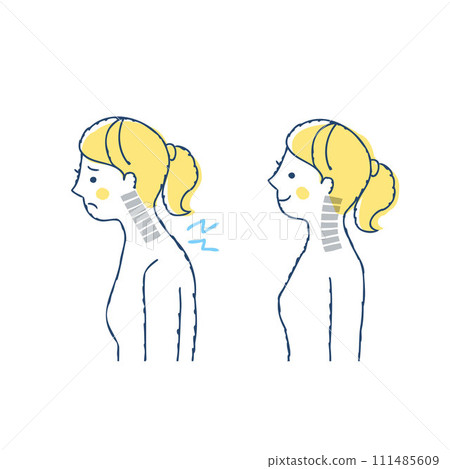 女性直頸與正常頸椎對比 111485609