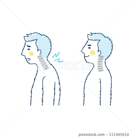 男性直頸與正常頸椎對比 111485610