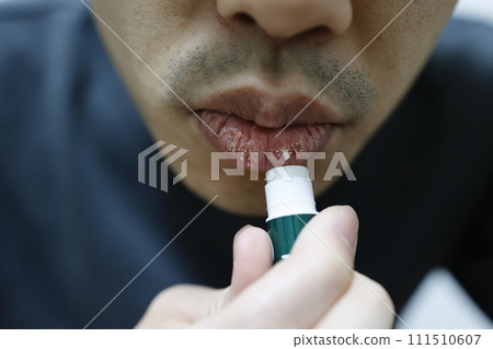 Man applying lip balm to dry lips Man applying lip balm to dry lips 111510607