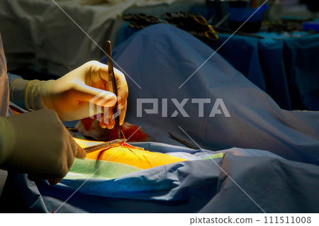 Stitching up leg after an injury by doctors in surgery room 111511008