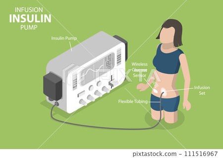 3D Isometric Flat Vector Illustration of Insulin Infusion Pump 3D Isometric Flat Vector Illustration of Insulin Infusion Pump 111516967