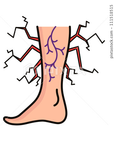 Varicose treatment icon. Violation of circulatory system. Vascular disease diagnostic. Venous insufficiency medical disease. Vector illustration Varicose treatment icon. Violation of circulatory system. Vascular disease diagnostic. Venous insufficiency medical disease. Vector illustration 111518515