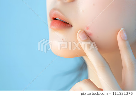Close-up photo of an Asian woman concerned about acne Close-up photo of an Asian woman concerned about acne 111521376