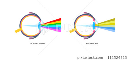 Protanomaly and protanopia Protanomaly and protanopia 111524513
