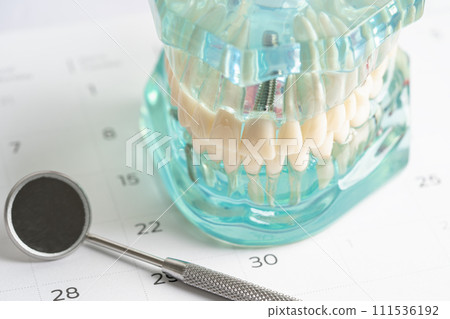Dental implant, artificial tooth roots into jaw, root canal of dental treatment, gum disease, teeth model for dentist studying about dentistry. Dental implant, artificial tooth roots into jaw, root canal of dental treatment, gum disease, teeth model for dentist studying about dentistry. 111536192