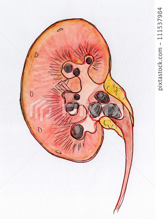 Hand drawn watercolor illustration of kidney stones Hand drawn watercolor illustration of kidney stones 111537984