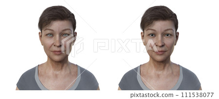 A woman with dilated and constricted eye pupils, illustration 111538077