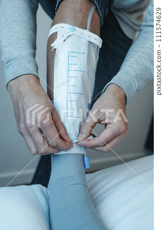 man attaching a urine drainage bag to his leg man attaching a urine drainage bag to his leg 111574629