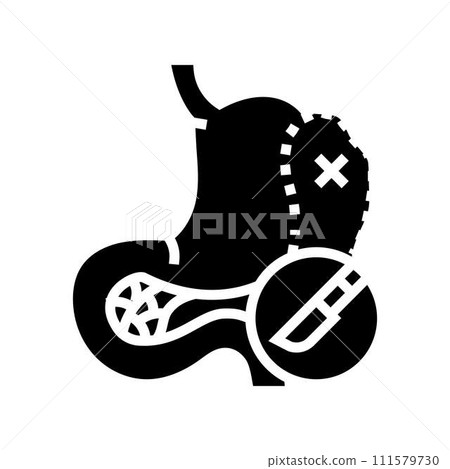 splenectomy surgery hospital glyph icon vector illustration splenectomy surgery hospital glyph icon vector illustration 111579730