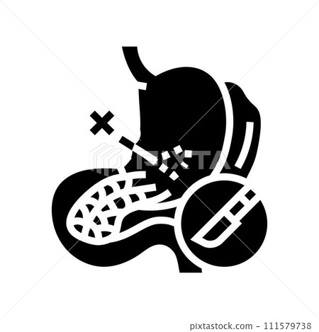 pancreatectomy surgery hospital glyph icon vector illustration 111579738