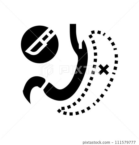 gastrectomy surgery doctor glyph icon vector illustration gastrectomy surgery doctor glyph icon vector illustration 111579777