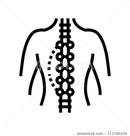 scoliosis surgery surgery hospital line icon vector illustration 111580209
