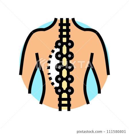 scoliosis surgery surgery hospital color icon vector illustration 111580801