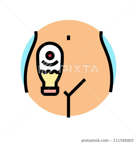 ostomy surgery hospital color icon vector illustration 111580805