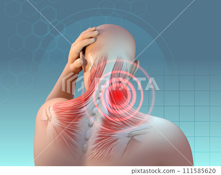 Neck and shoulder pain 111585620