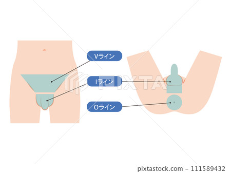 男性VIO脫髮面積 111589432
