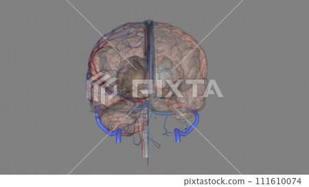 The sigmoid sinus is a paired intracranial venous channel The sigmoid sinus is a paired intracranial venous channel 111610074