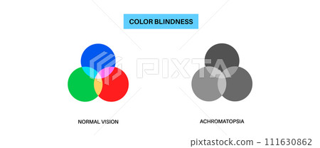 Achromatopsia vision deficiency 111630862